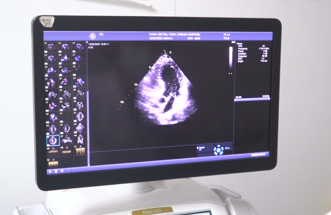 卵圓孔未閉屬于大病嗎(卵圓孔未閉屬于重大疾病嗎)-添財(cái)網(wǎng)