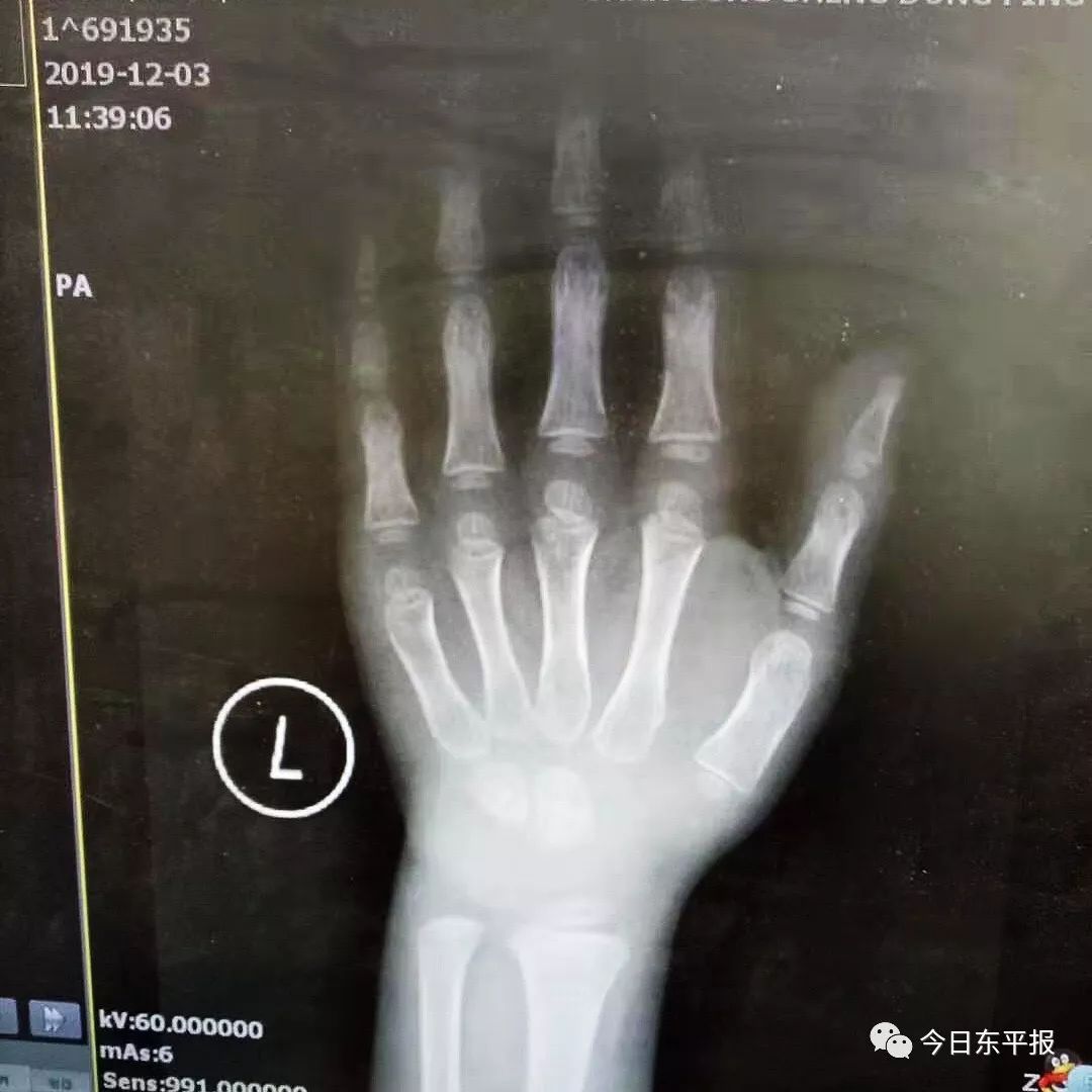 打生長激素可以報銷嗎(打生長激素屬于報銷范疇嗎)-添財網