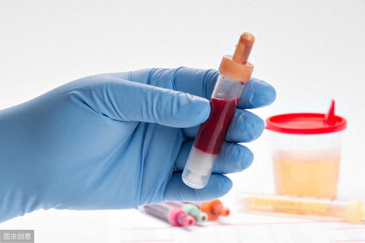 男性突然無痛尿血原因(男性突然無痛尿血原因)-添財網