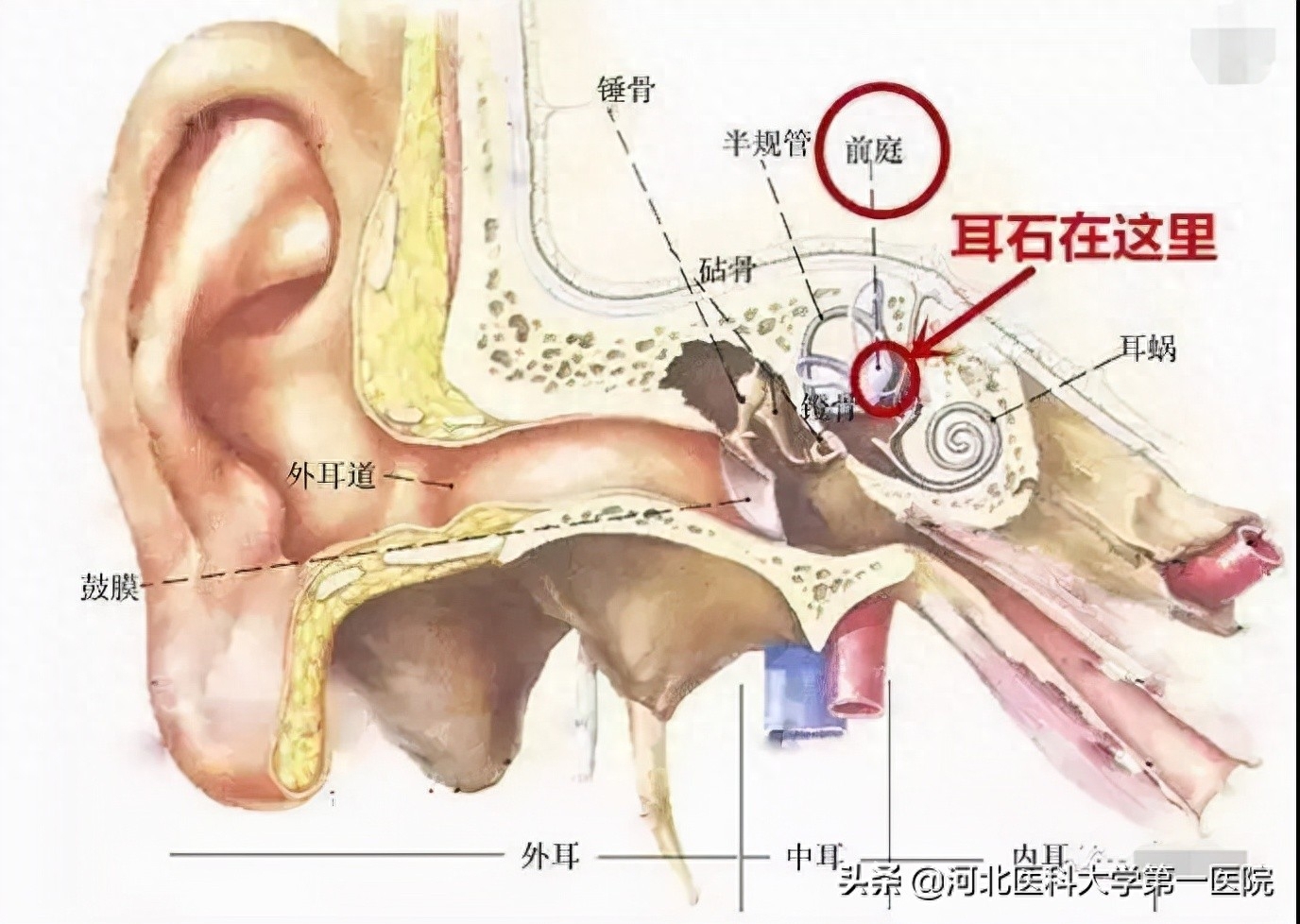 梅尼埃病算大病嗎(大病患者是指)-添財網